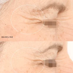 Irene Forte Night Renewal Travel Kit Hot